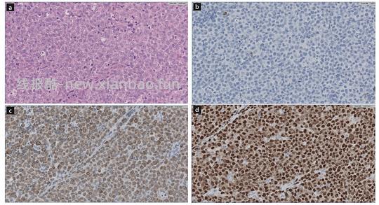 【科普】[养猫笔记08] 猫淋巴瘤（Feline Lymphoma）概述（1） - 线报酷